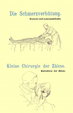 Die Schmerzverhütung (Narkose) & Kleine Chirurgie der Zähne