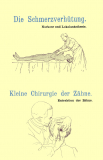 Die Schmerzverhütung (Narkose) & Kleine Chirurgie der Zähne